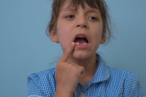 child with chipped or broken tooth and toothache